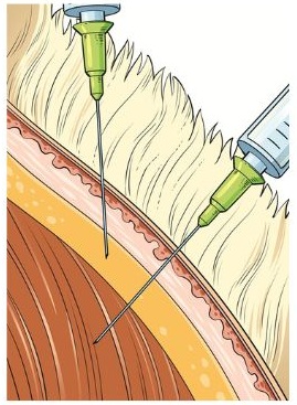 An Illustration showing the difference between subcutaneous and intramuscular injections in sheep. 